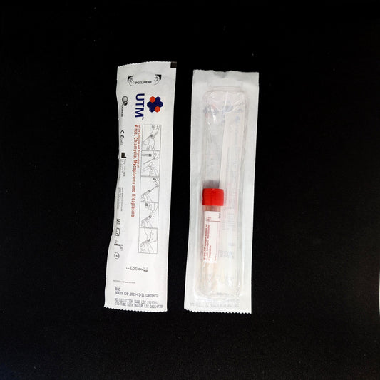 Mattilsynets beredskap (HPAI/ND/kverke)